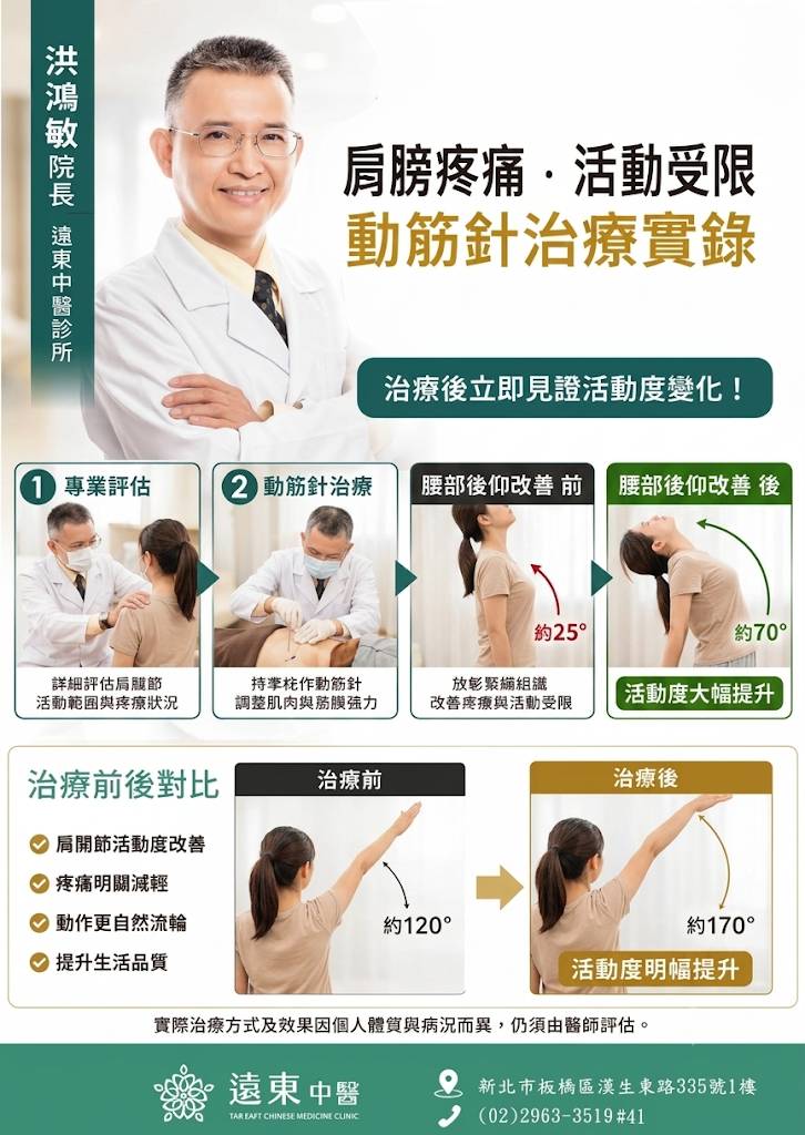 肩膀疼痛活動受限，動筋針療法